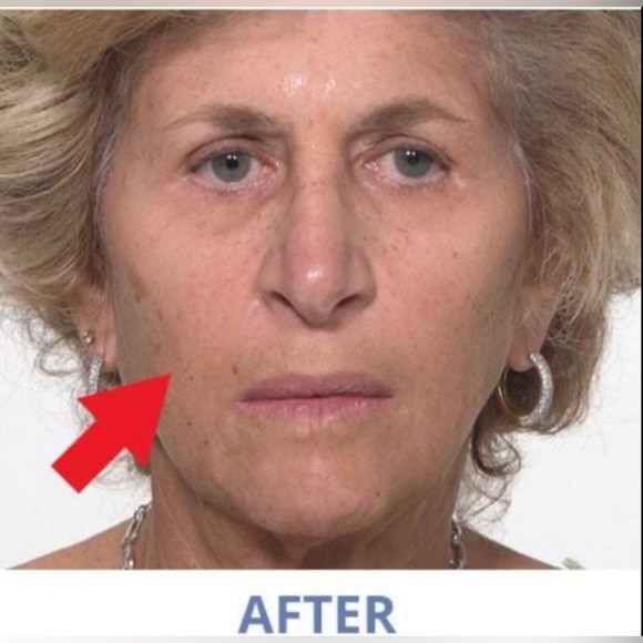 Fast Acting Eye Serum, Tint & Tighten (5) - Picture 4 of 15